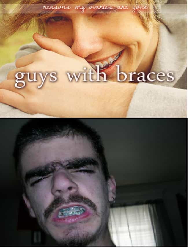 Boys With Braces