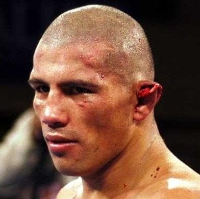 The Worst Boxing Injuries (Page 2)