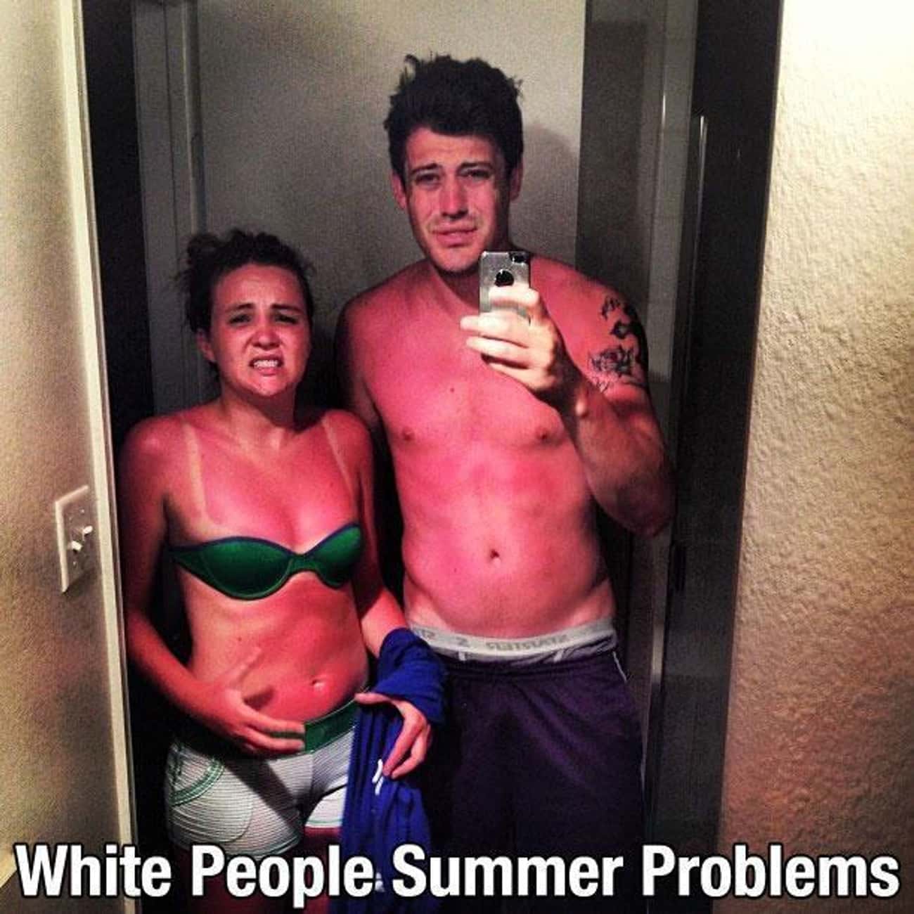 These Two Who Didn&#39;t Think Sunscreen Was That Important