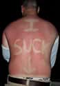 This Guy Who Sucks on Random Epic and Painful Sunburns