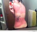 Tattoos Cut In Half on Random Epic and Painful Sunburns