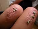 These Legs After Kneeling on Frozen Peas on Random Vomit-Inducing Photos Will Trigger Your Trypophobia