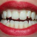 Mistake: Lipstick on Teeth on Random Common Mistakes in Beauty Routine