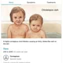 Chicken Pox: You and Your Brother Sit Quietly in the Bathtub on Random Weird Medical Drawings Google Thinks You Need