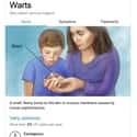 Warts: You'll Need Your Mom to Carefully Inspect Your Hand on Random Weird Medical Drawings Google Thinks You Need