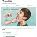 Tonsilitis: Don't Be Afraid of Disembodied Hands Touching Your Face on Random Weird Medical Drawings Google Thinks You Need