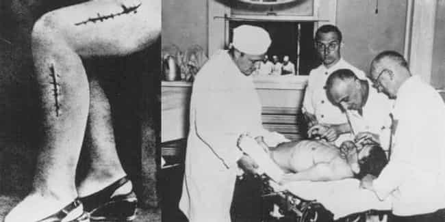 Bone Grafting is listed (or ranked) 4 on the list The Most Horrifying Nazi Experiments on Humans