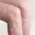 Liposuction For The Knees on Random Most Bizarre Plastic Surgery Procedures