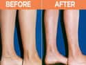 Get Rid Of Cankles on Random Most Bizarre Plastic Surgery Procedures