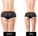 The Thigh Gap You Always Wanted on Random Most Bizarre Plastic Surgery Procedures