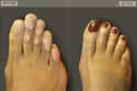 Toe-tally Awesome Surgery on Random Most Bizarre Plastic Surgery Procedures