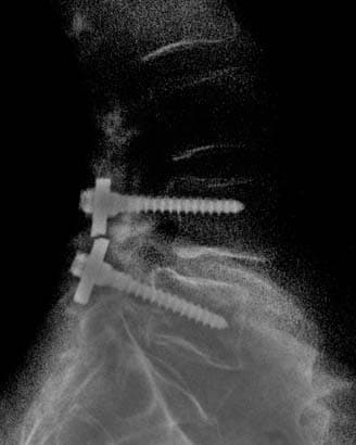 Arturo Iturralde and a Screwdr is listed (or ranked) 7 on the list The Worst Medical Malpractice Stories in History