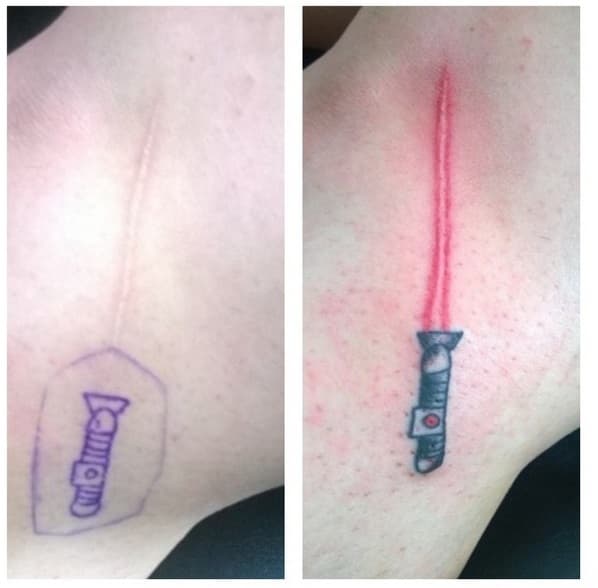 Tattoo On Scar / Pin On My Kind Of Ink : Inking a tattoo on scar is perhaps the only way to restore the lost attractiveness of body after injuries, surgeries and diseases.