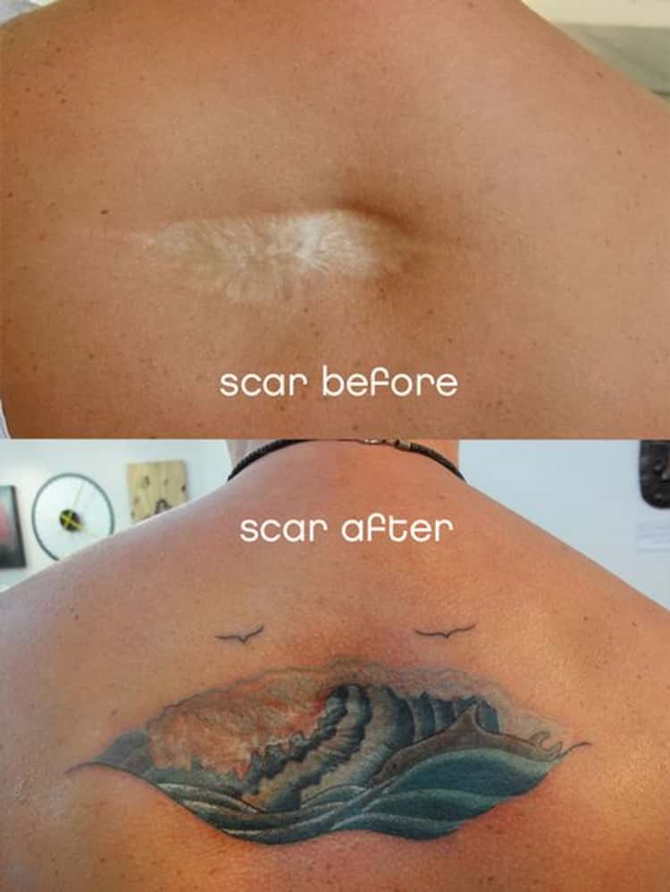 23 Amazing Scar Cover Up Tattoos That Will Blow You Away
