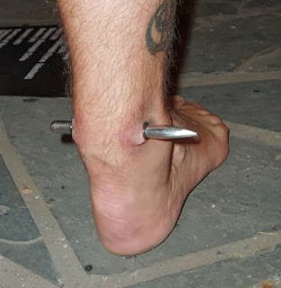 16 Extreme Body Modifications You Have to See to Believe