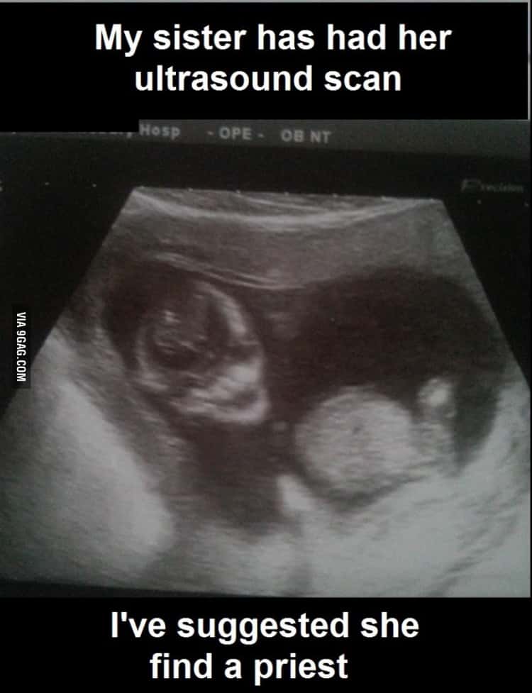 29 Funny Ultrasound Pictures That'll Creep You Out