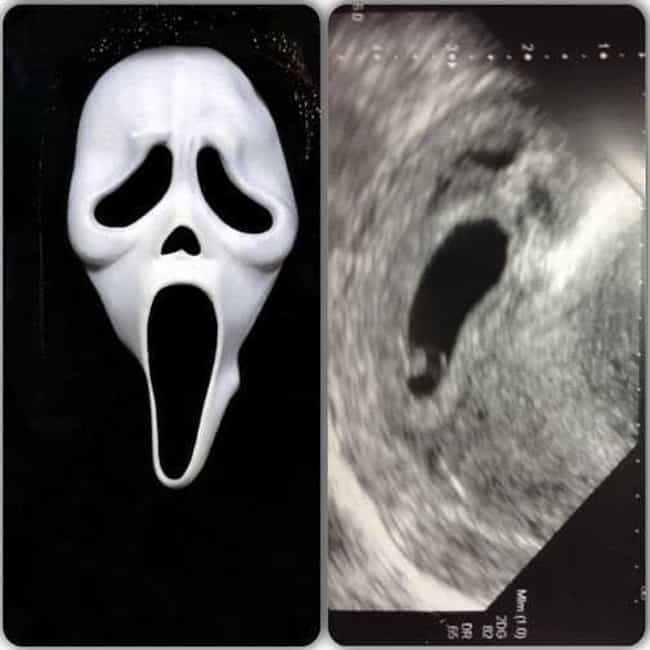 Creepy Ultrasound Pictures That'll Make You Never Want Kids - ViraLuck