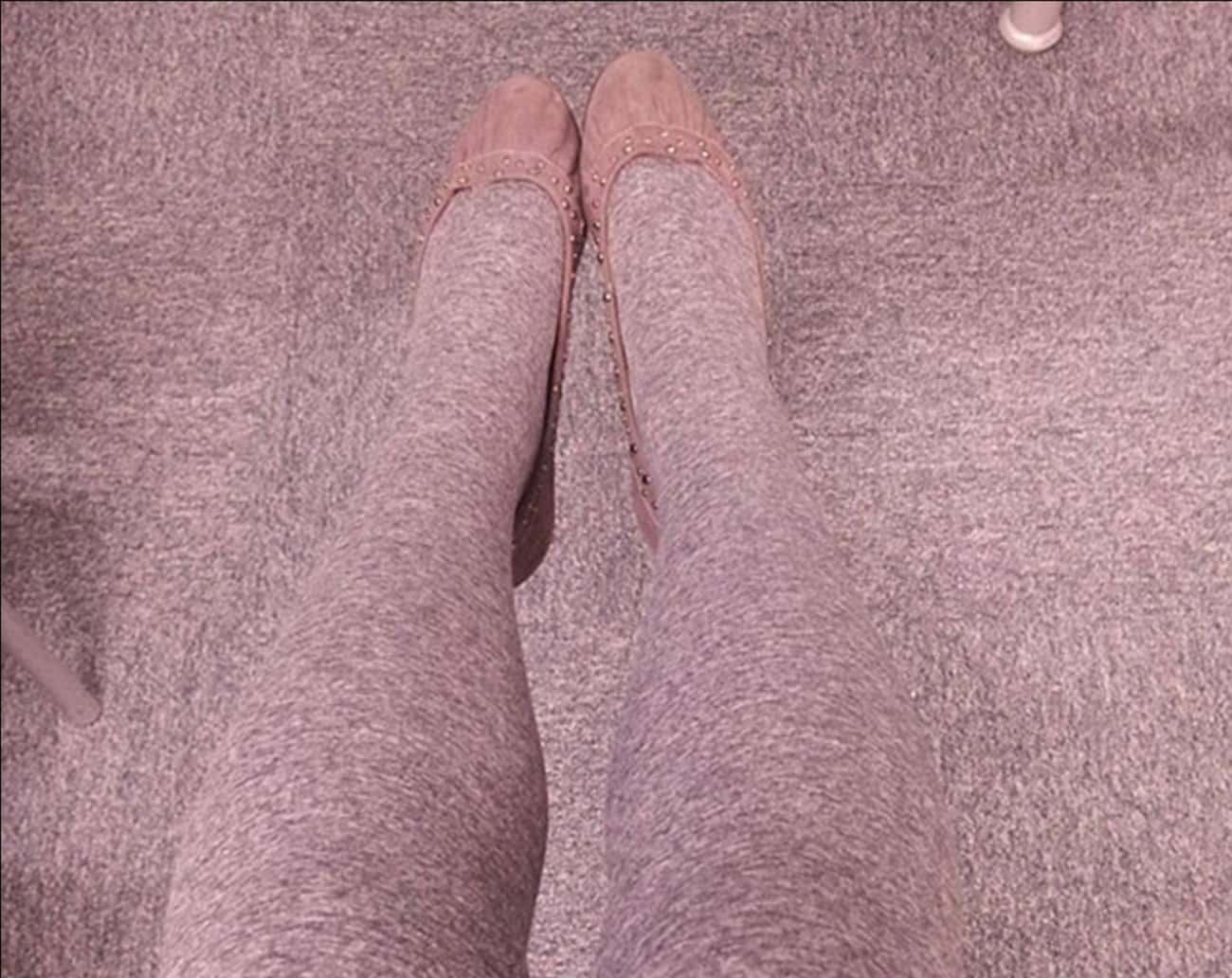 This Woman Who Sadly Lost Her Legs in a Sea of Carpet