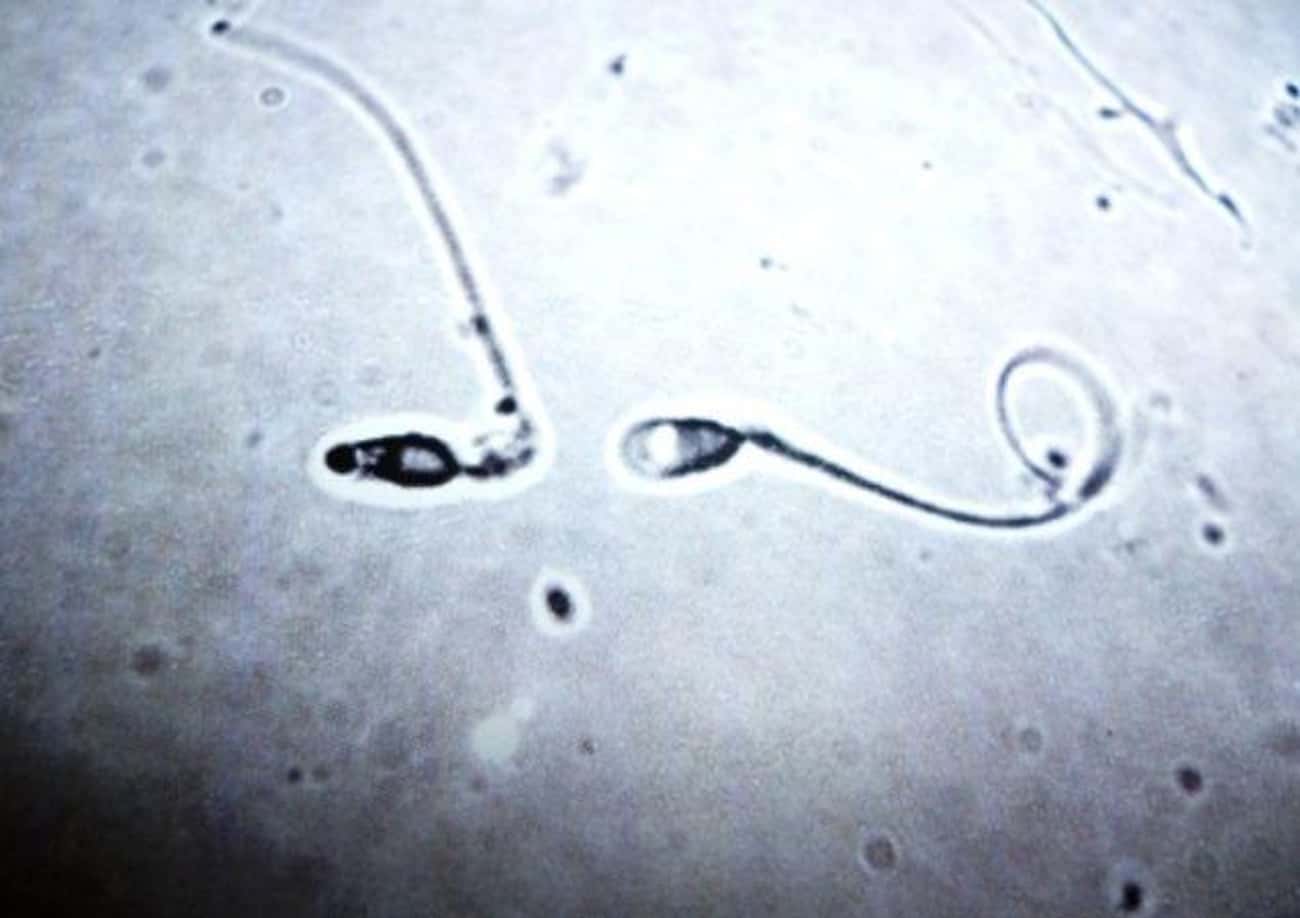 сперма из влагалища у малолеток фото 83