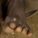 Guinea Worm on Random Parasites That Could Ruin Your Next Vacation
