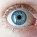 Blue Eyes on Random Most Common Recessive Genes In Humans