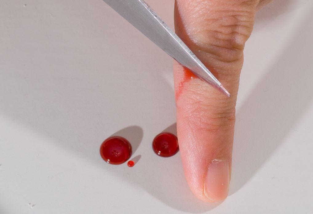 Random Creepy Facts About Bleeding Out That Make Our Skin Crawl