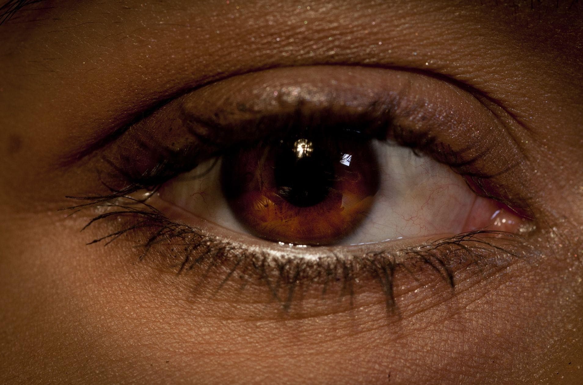 Dots in a Pregnant Woman's Iris Indicate Her Baby's Sex