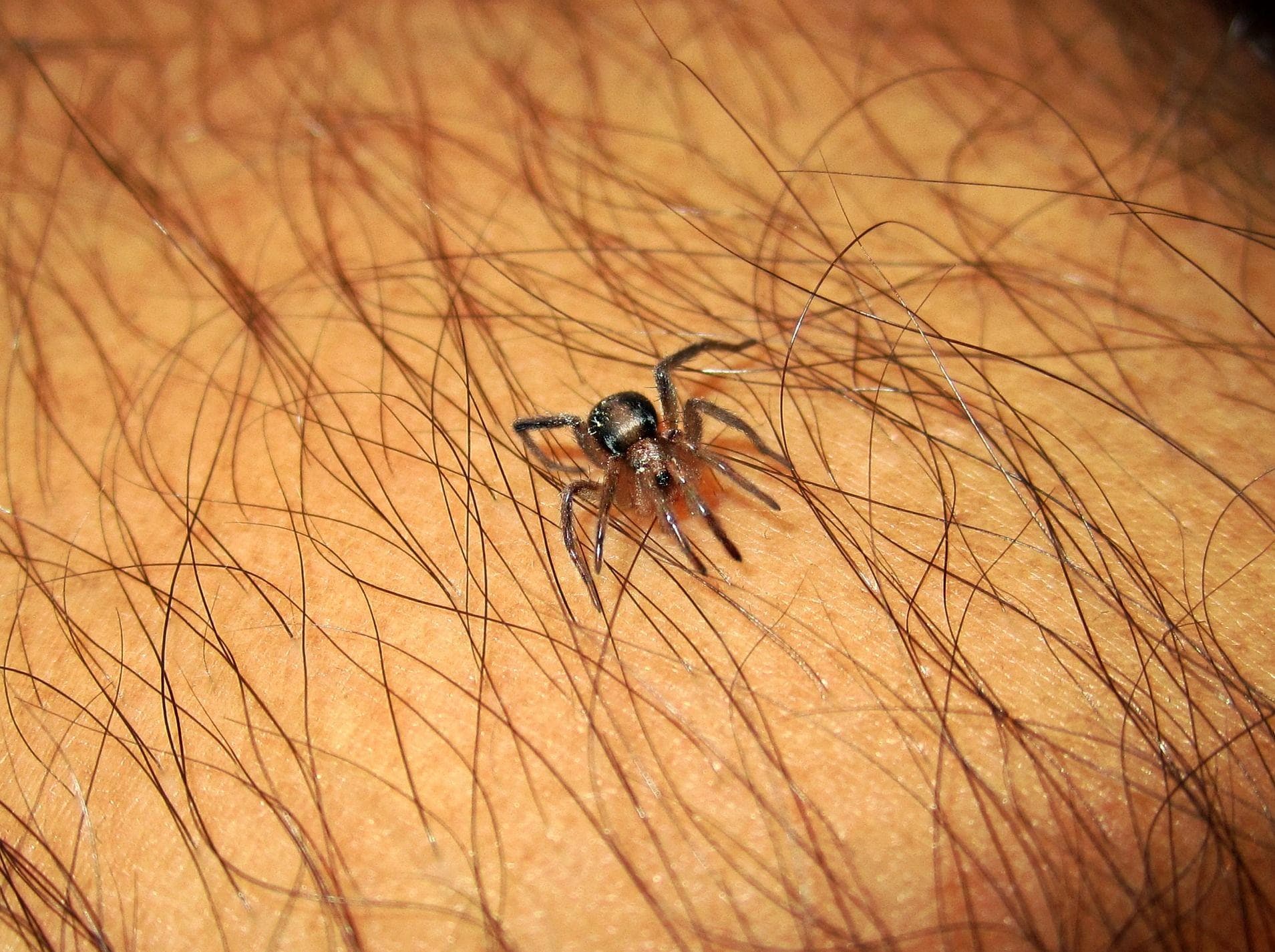 Image of Random Horrifying Things That Happen to Your Body When You Get a Deadly Spider Bite