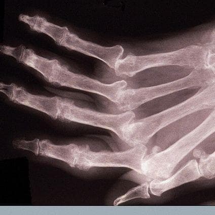 The Wackiest Scientists to Ever Win the Ig Nobel Prize