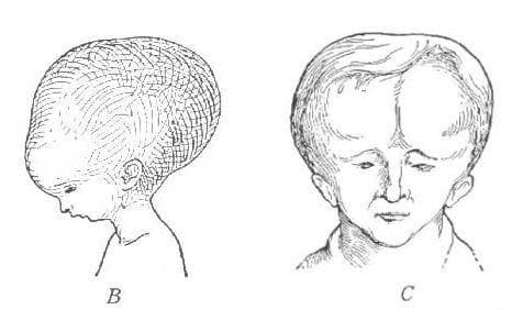 The Melonheads is listed (or ranked) 3 on the list 12 Ghost Stories And Urban Legends That Prove Ohio Is The Creepiest State