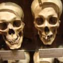 The Mutter Museum In Philadelphia on Random Museums In America You Won't Believe Actually Exist