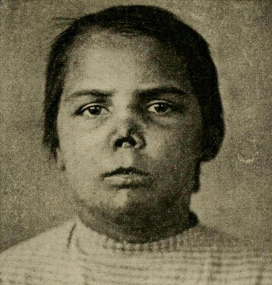 Болезни Европы (16-19 века) - презентация онлайн