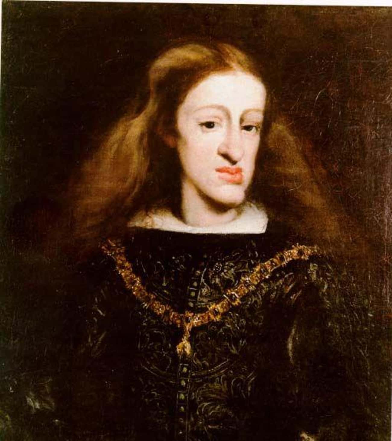 Charles II Had A Massive, Drool-Secreting Tongue