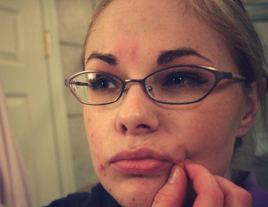 it s more than just picking a little skin photo u1?w=650&q=50&fm=jpg&fit=crop&crop=faces