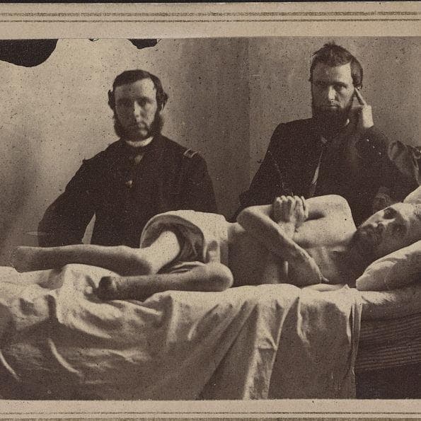 14 Grisly Facts About Civil War Battlefield Surgery   Amputation Was A Common Operation Photo U2