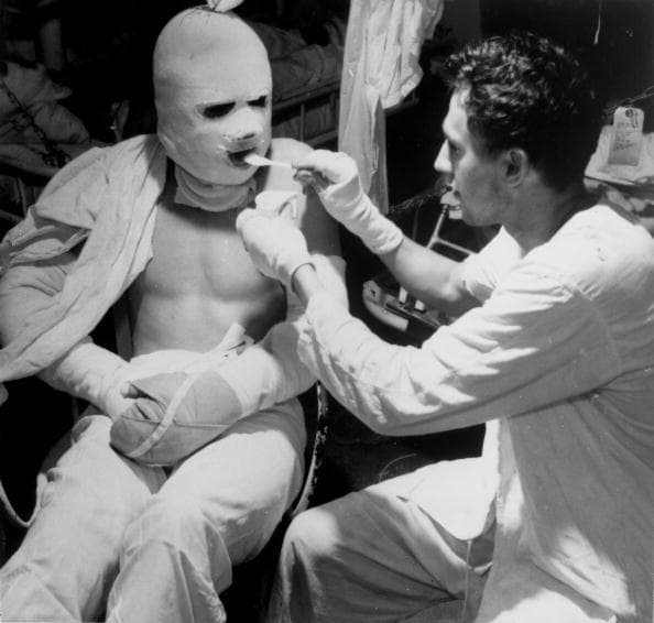 Soldier Treated For Burns After Ship Attacked By Kamikaze Pilot 