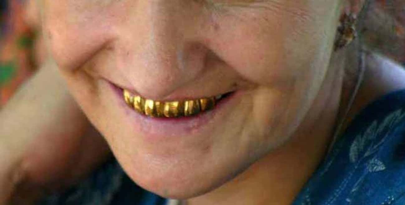 Золотые зубы фото Золотые зубы фото