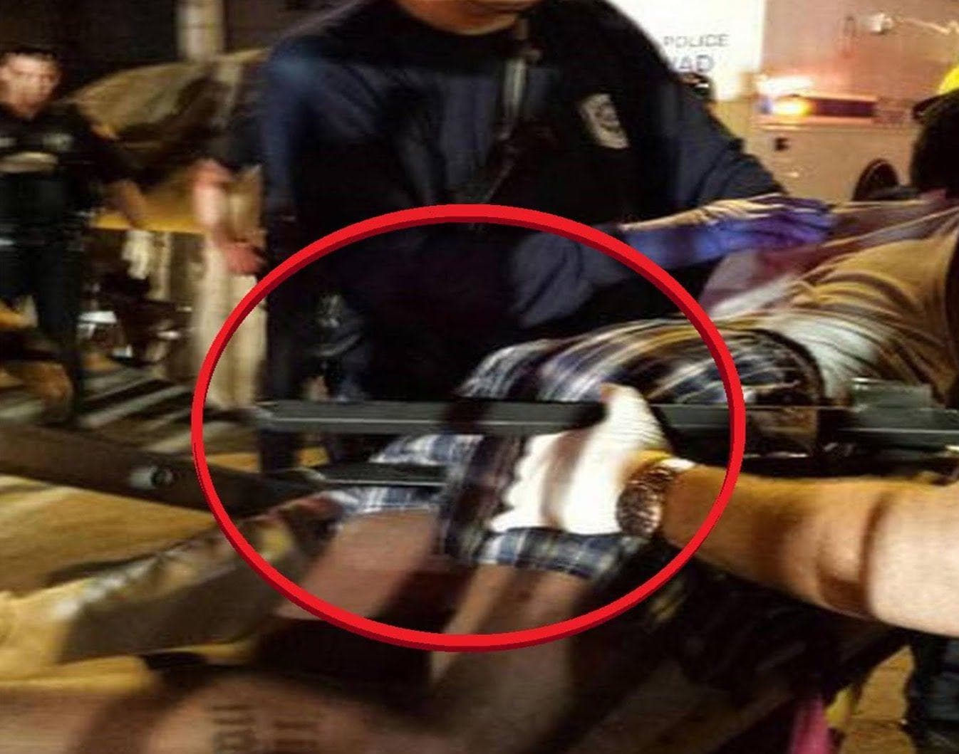 this-man-impaled-himself-on-police-department-fence-while-on-flakka-photo-u1