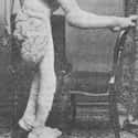 He Was Born A Healthy Child on Random Heartbreaking Facts About Joseph Merrick, The Elephant Man
