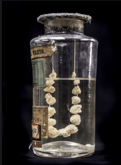 Image of Random Super Weird And Disgusting Things On Display At The Mütter Museum