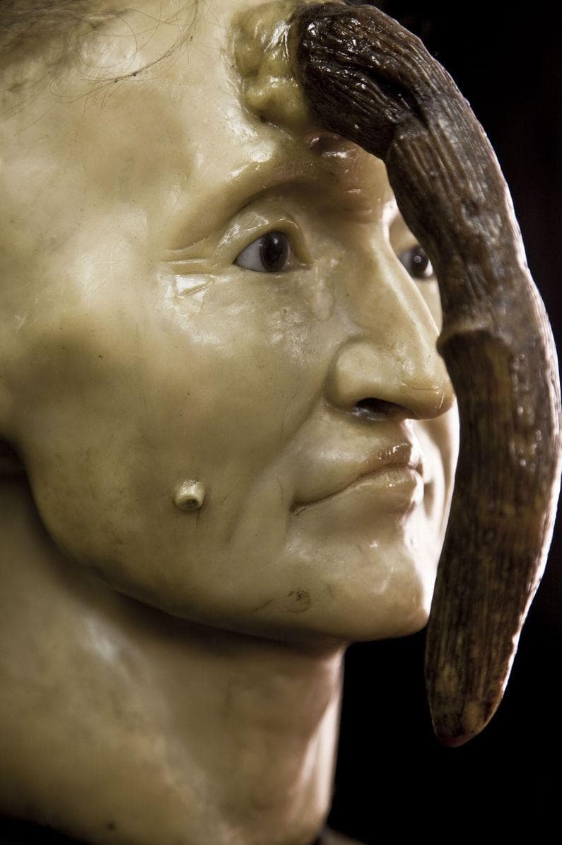 13 Super Weird And Disgusting Things On Display At The Mütter Museum
