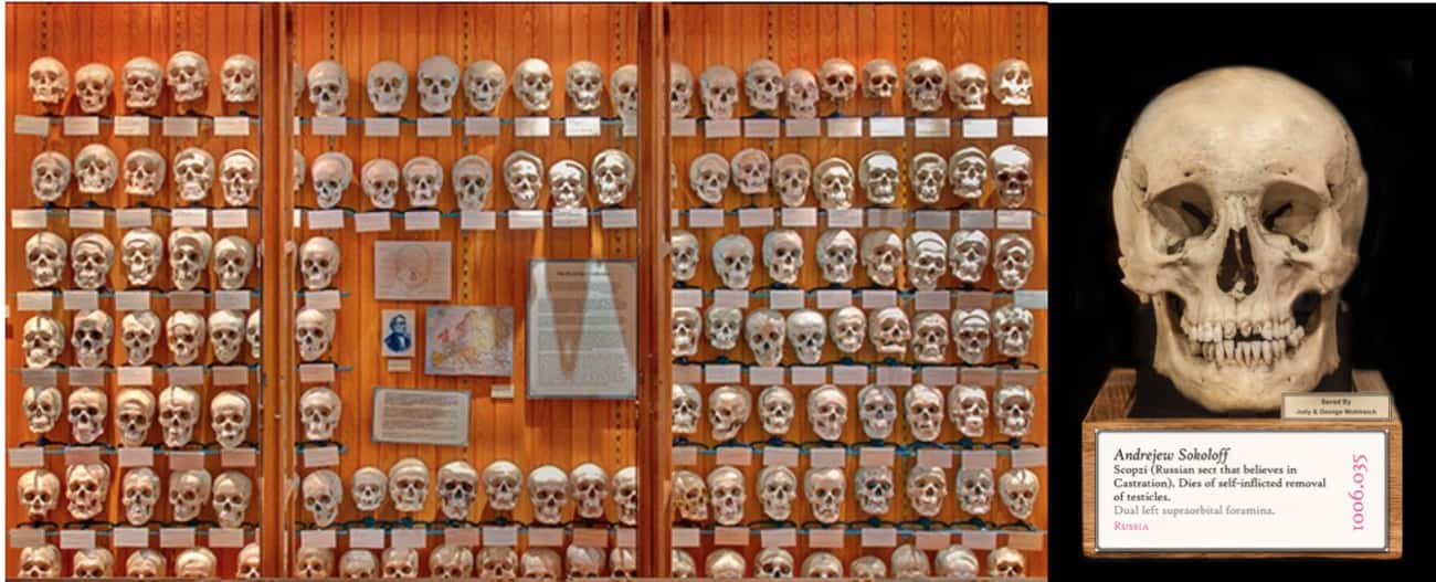 The Massive Collection Of Skulls