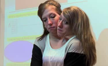 Things Most People Don T Know About Conjoined Sisters Abby And Brittany