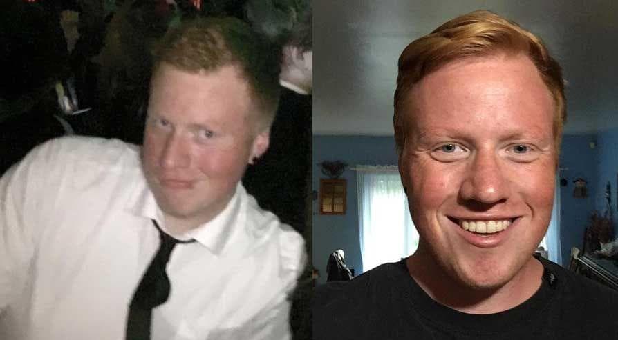 People Share Their BeforeAndAfter Photos Of Quitting