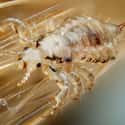 Head Lice, Little Guys That Love Your Scalp's Thin Skin on Random Fascinating, Slightly Disgusting Creatures That Can Live On Your Body