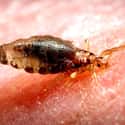 Body Lice, Who Evolved Along With Human Clothing on Random Fascinating, Slightly Disgusting Creatures That Can Live On Your Body