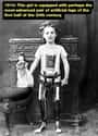 1910: The Best Prosthetic Legs Of The Time on Random Eye-Opening Photos of Children Throughout History