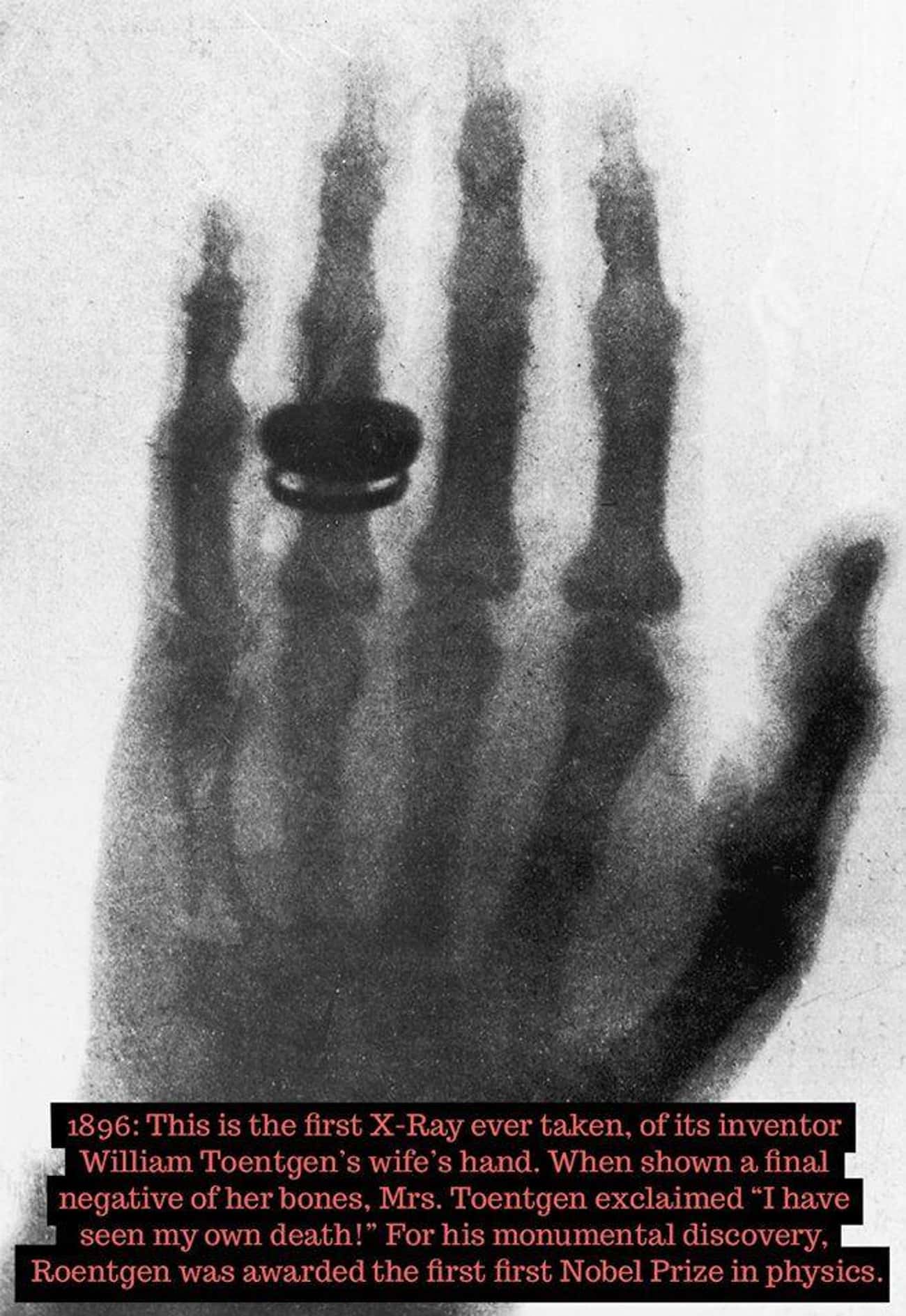 1896: The First X-Ray