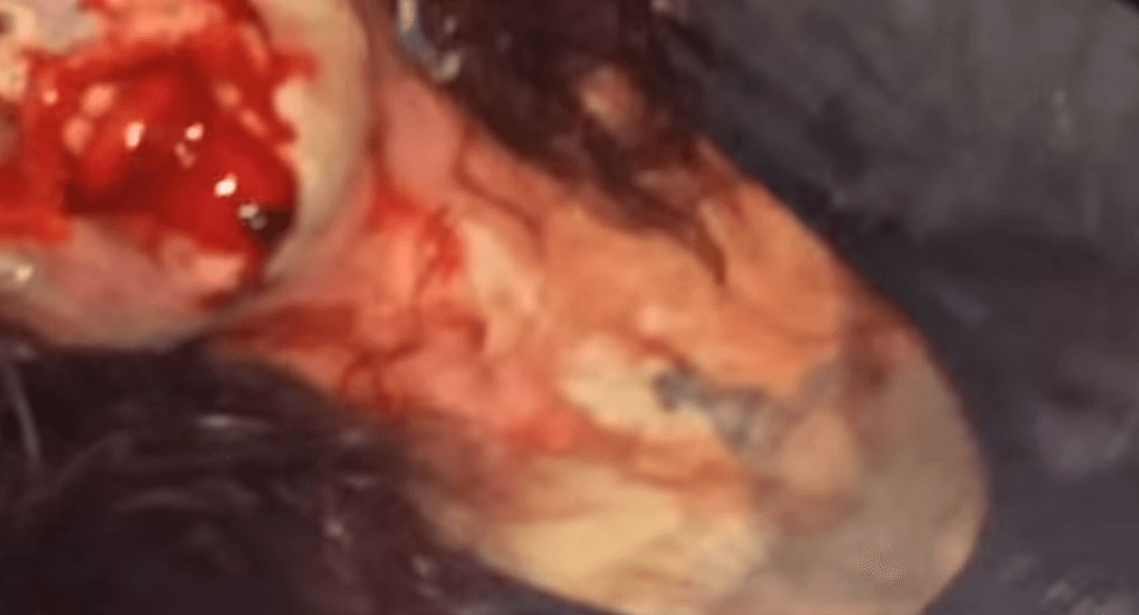 Taken From Some Incredibly Bloody Cellphone Footage Out Of Texas