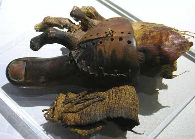 Egypt Probably Had The First P... is listed (or ranked) 4 on the list 10 Bizarre Facts About What Surgery Was Like In Ancient Egypt